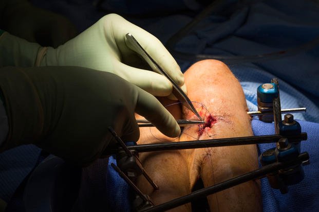 doctor sews up an open wound on a patient during a surgery