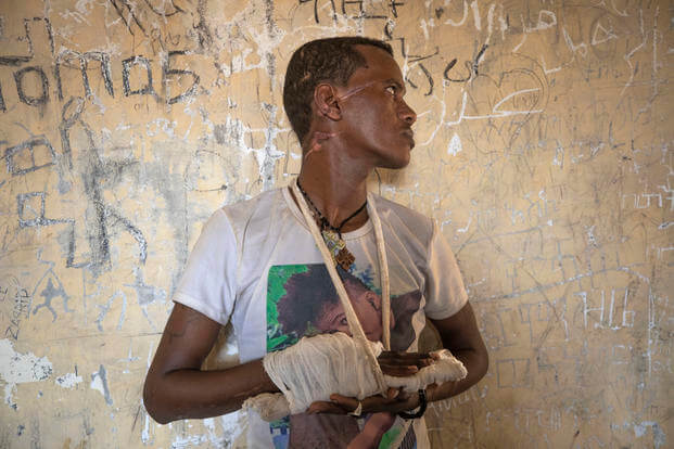 Ethnic Tigrayan survivor Abrahaley Minasbo, 22, from Mai-Kadra, Ethiopia