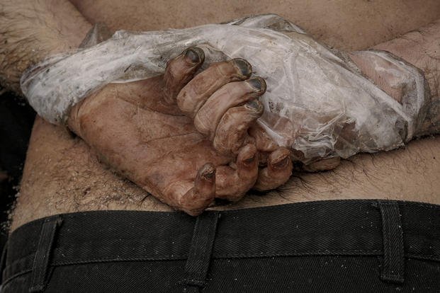 A lifeless body of a man with his hands tied behind his back in Bucha, Ukraine.