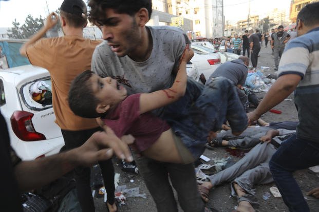 An injured Palestinian boy is carried.