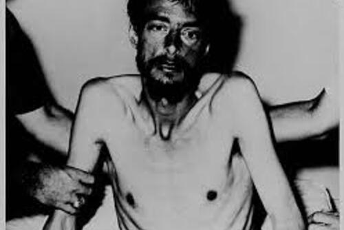 Dieter Dengler is photographed after being rescued following his escape from Vietnam, weighing 93 pounds. (Matthäus Dengler)